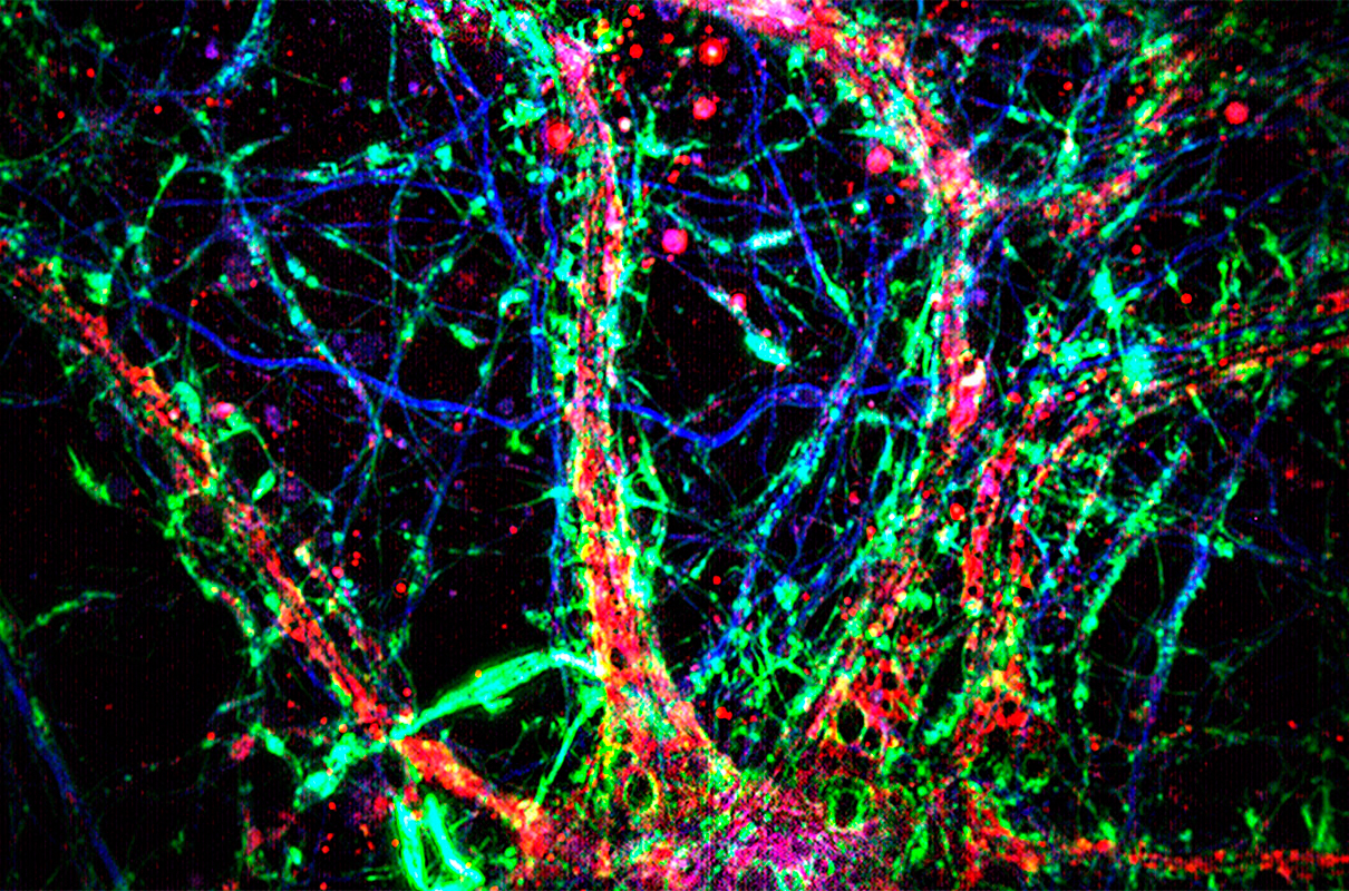 El Jardín Interconectado